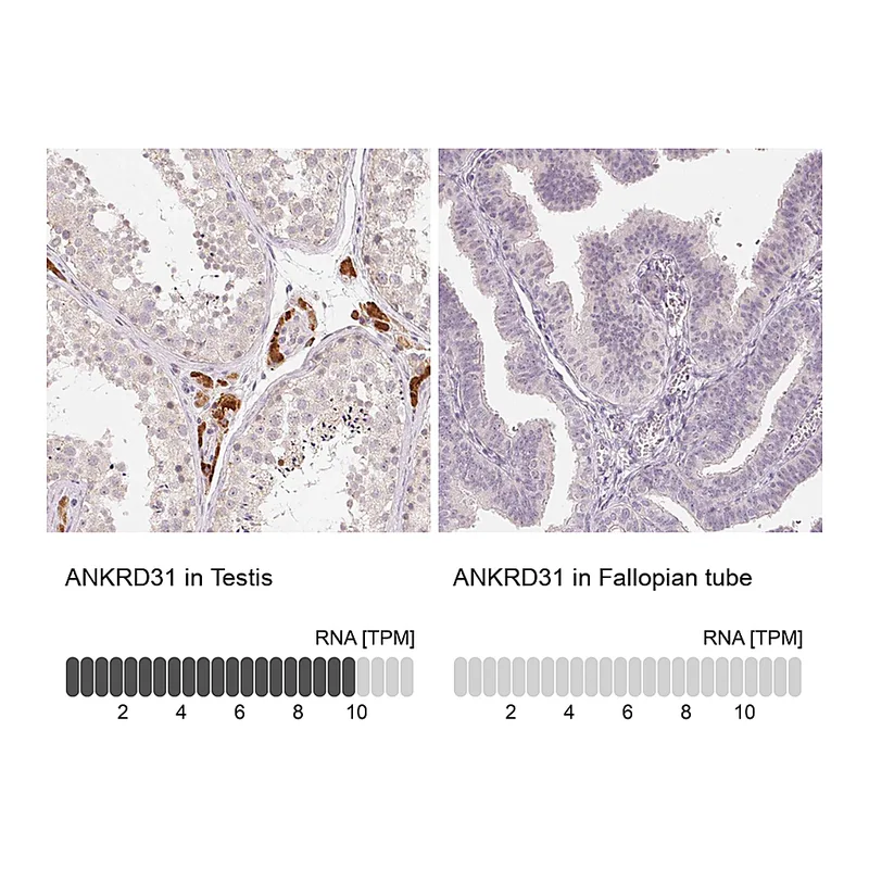 Atlas Antibodies Anti-ANKRD31 Antibody