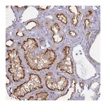 Atlas Antibodies Anti-ANKRD33 Antibody