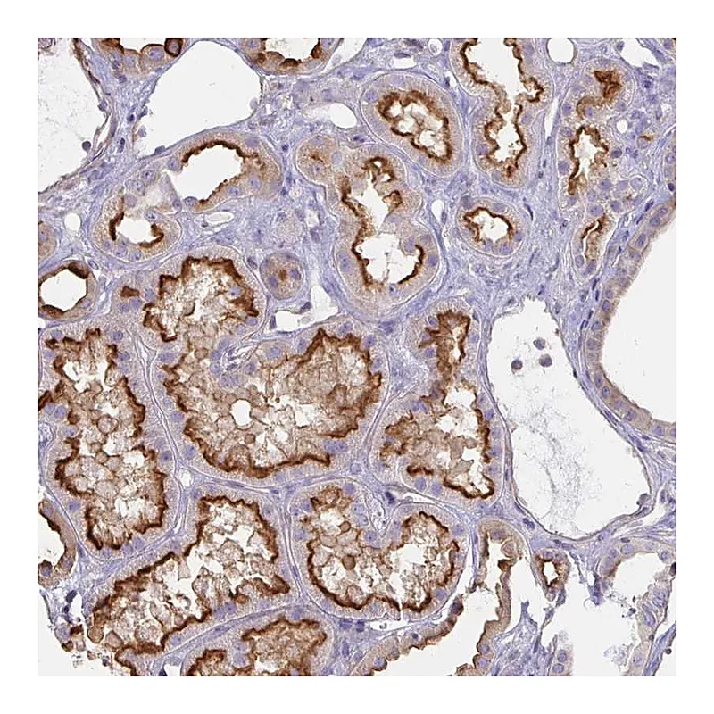 Atlas Antibodies Anti-ANKRD33 Antibody