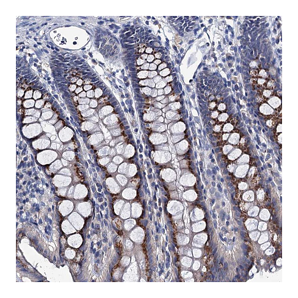 Atlas Antibodies Anti-ANKRD33 Antibody