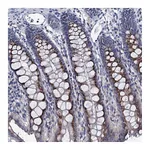 Atlas Antibodies Anti-ANKRD33 Antibody