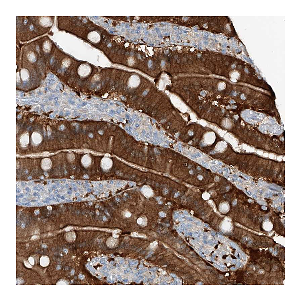 Atlas Antibodies Anti-ANKRD34A Antibody
