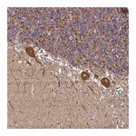 Atlas Antibodies Anti-ANKRD33B Antibody