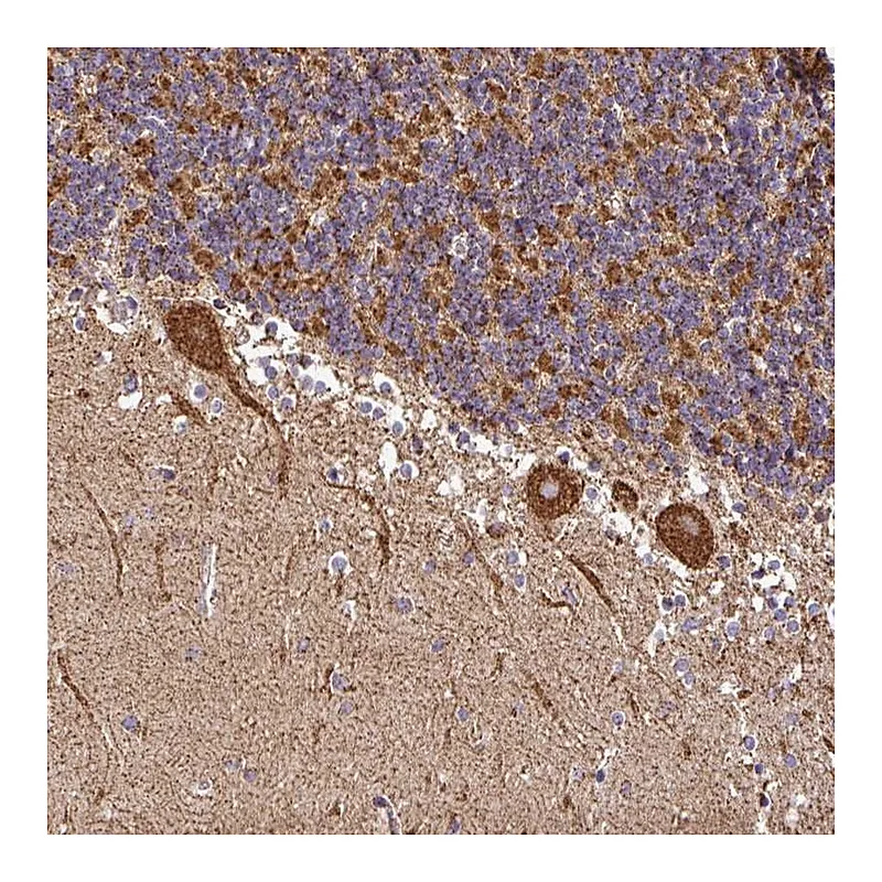 Atlas Antibodies Anti-ANKRD33B Antibody