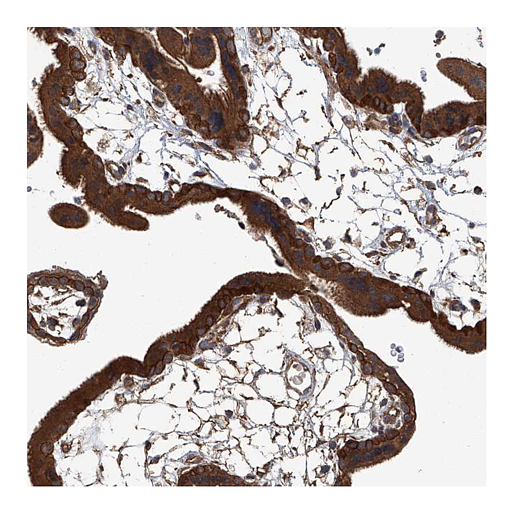 Atlas Antibodies Anti-ANKRD34A Antibody