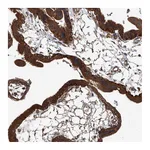 Atlas Antibodies Anti-ANKRD34A Antibody