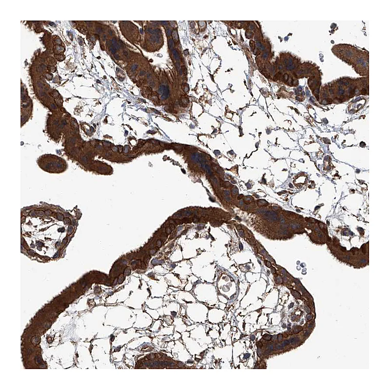 Atlas Antibodies Anti-ANKRD34A Antibody