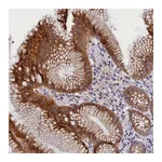 Atlas Antibodies Anti-ANKRD34B Antibody