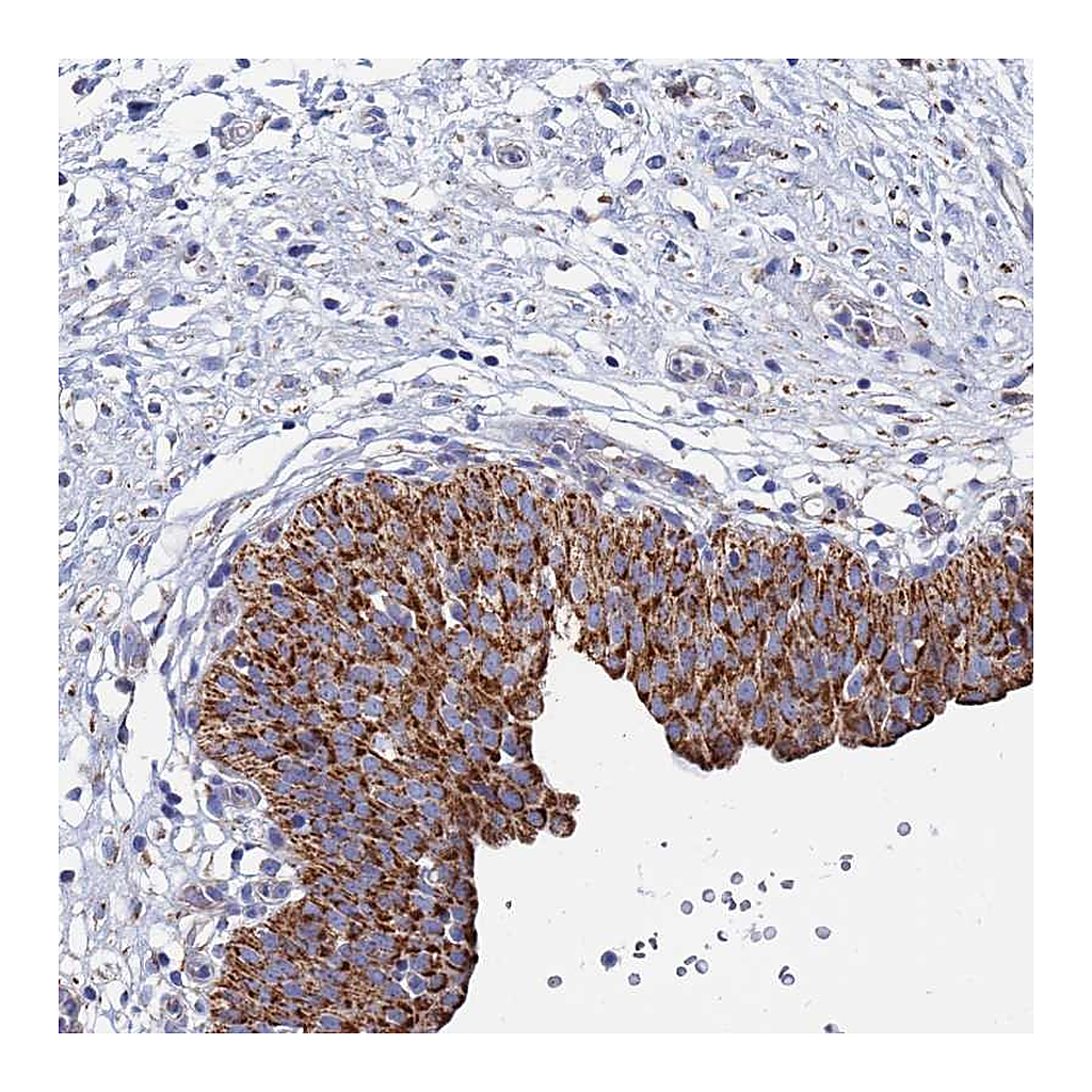 Atlas Antibodies Anti-ANKRD34C Antibody