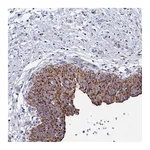 Atlas Antibodies Anti-ANKRD34C Antibody