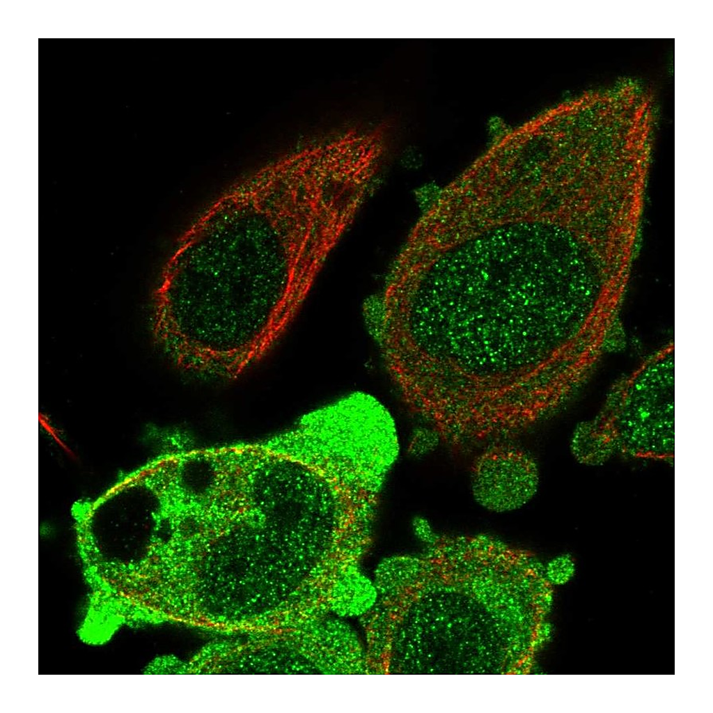 Atlas Antibodies Anti-ANKRD36 Antibody