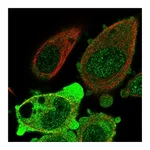 Atlas Antibodies Anti-ANKRD36 Antibody