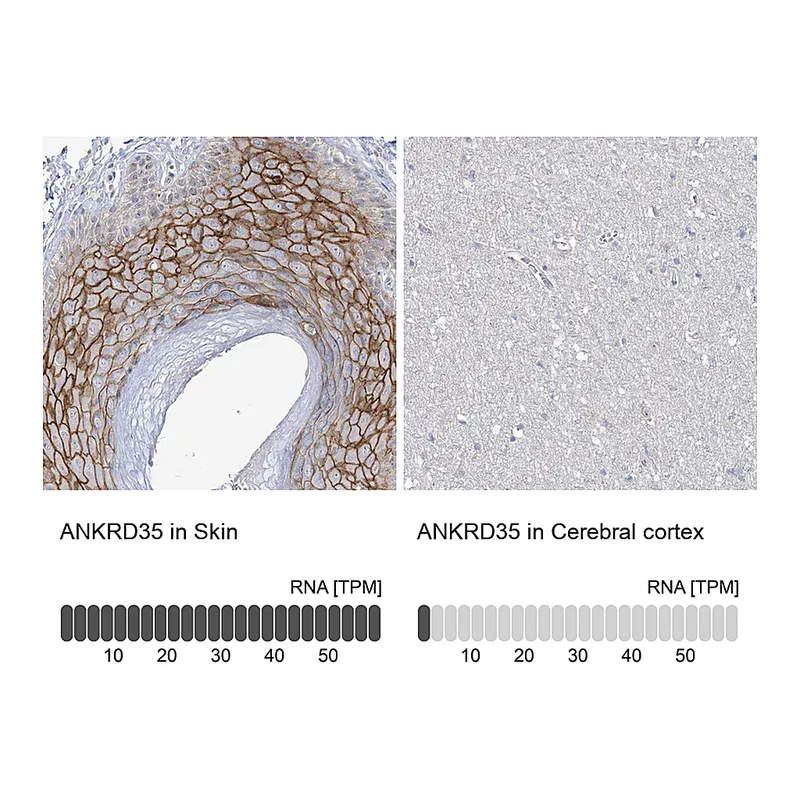 Atlas Antibodies Anti-ANKRD35 Antibody