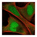 Atlas Antibodies Anti-ANKRD36C Antibody