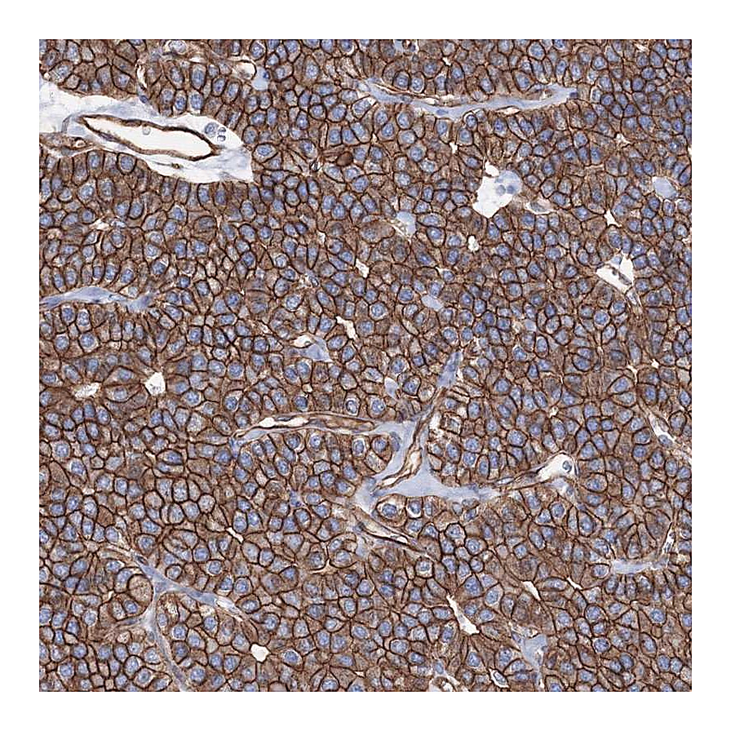 Atlas Antibodies Anti-ANKRD37 Antibody