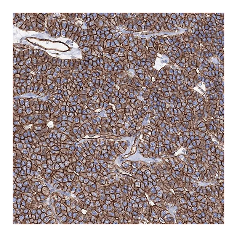 Atlas Antibodies Anti-ANKRD37 Antibody