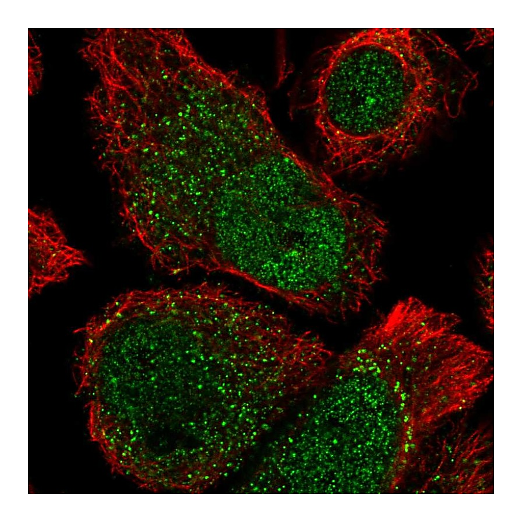 Atlas Antibodies Anti-ANKRD37 Antibody