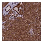 Atlas Antibodies Anti-ANKRD39 Antibody