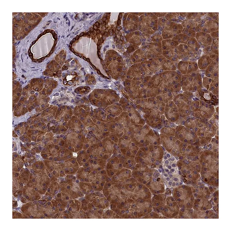 Atlas Antibodies Anti-ANKRD39 Antibody