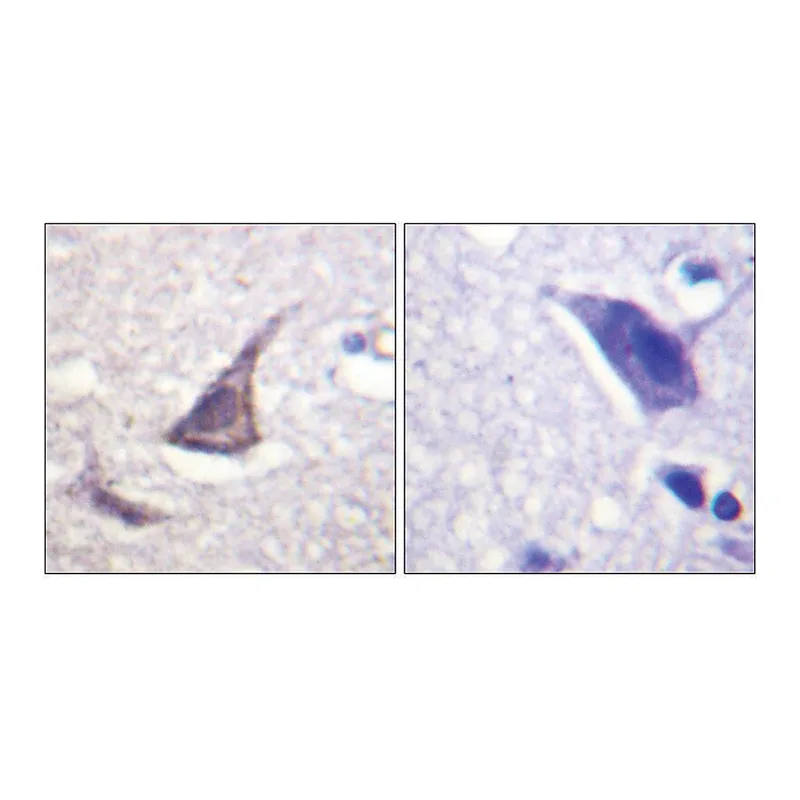 Merck Anti-Calcium Sensing Receptor antibody produced in rabbit