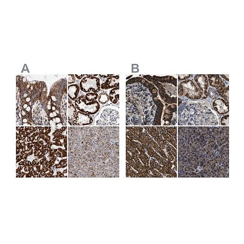 Merck Anti-ETFA antibody produced in rabbit