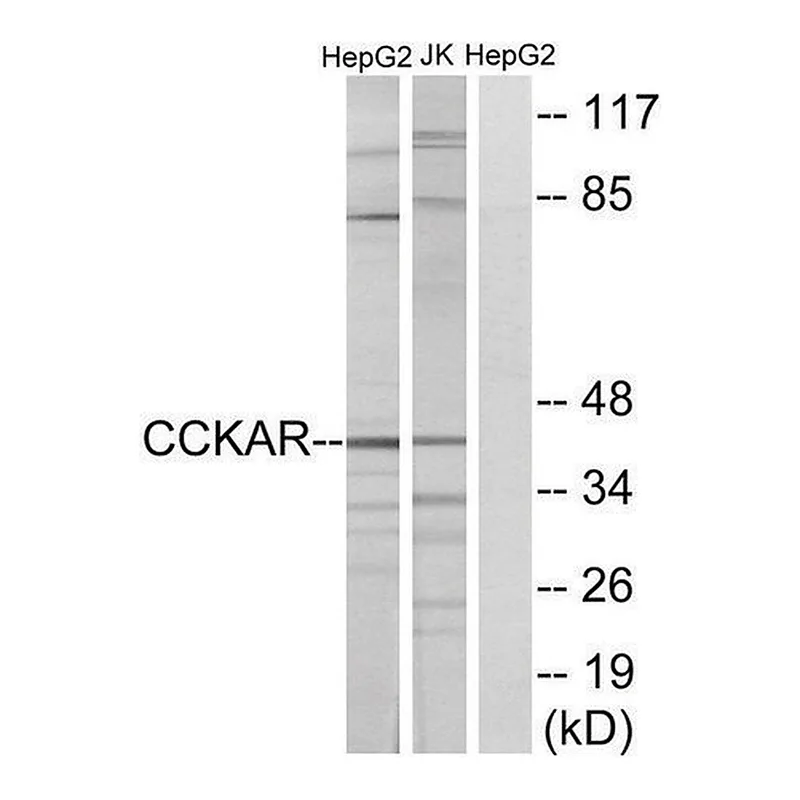 Merck Anti-CCKAR antibody produced in rabbit