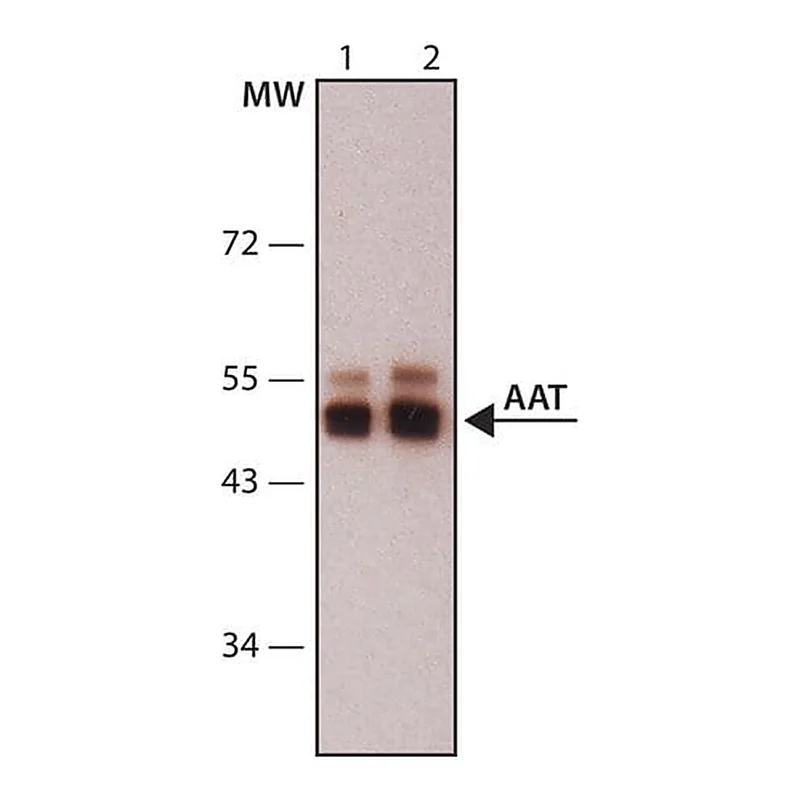 Merck Anti-Alpha-1-Antitrypsin (AAT) antibody,Mouse monoclonal