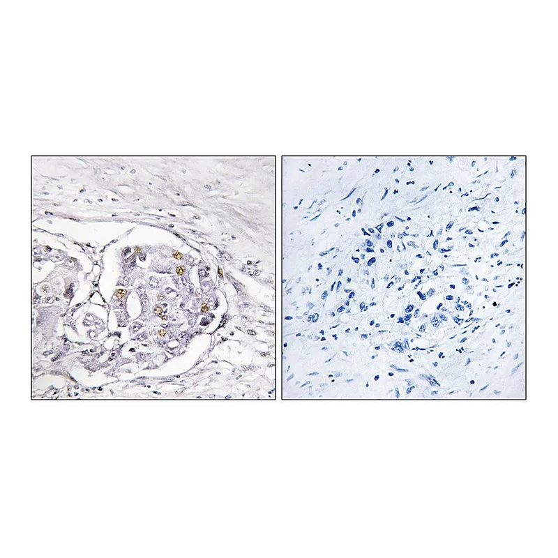 Merck Anti-Progesterone Receptor antibody produced in rabbit