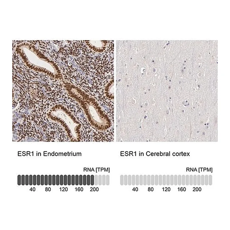 Merck Anti-ESR1 antibody produced in rabbit