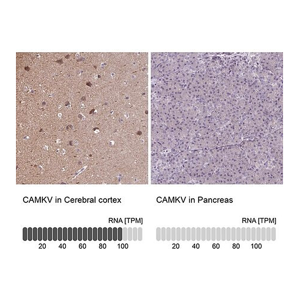 Merck Anti-CAMKV antibody produced in rabbit