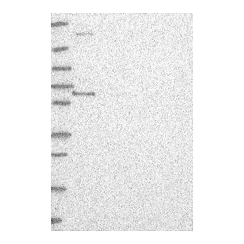 Merck Anti-ETV3 antibody produced in rabbit