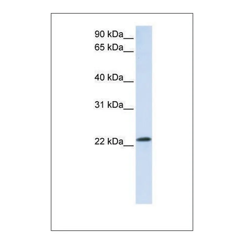 Merck Anti-RAB18 antibody produced in rabbit