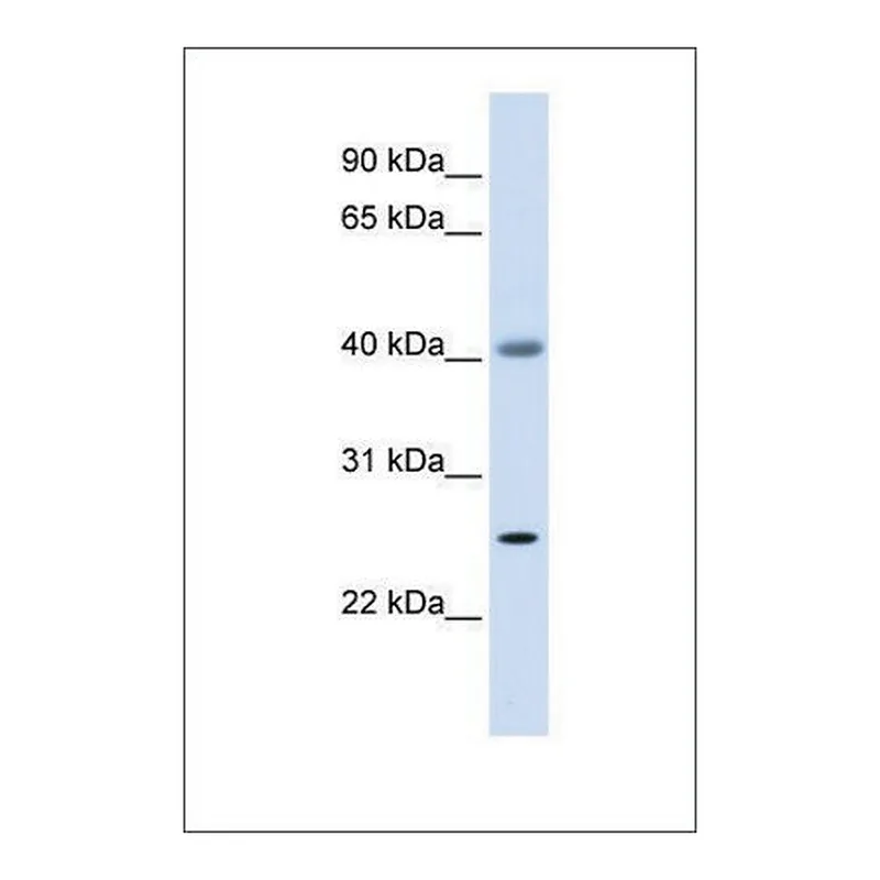 Merck Anti-ADA antibody produced in rabbit