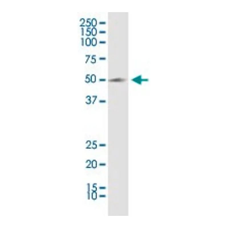 Merck Anti-KCNN4 antibody produced in rabbit
