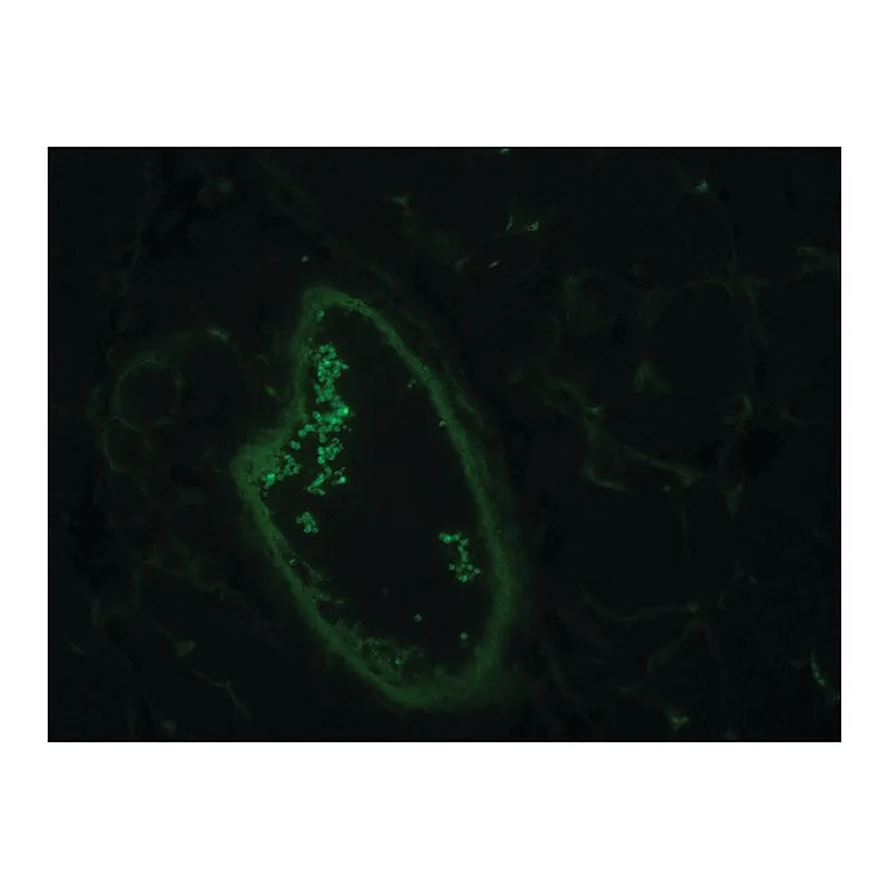 Merck Monoclonal Anti-Actin, Smooth Muscle antibody produced in mouse