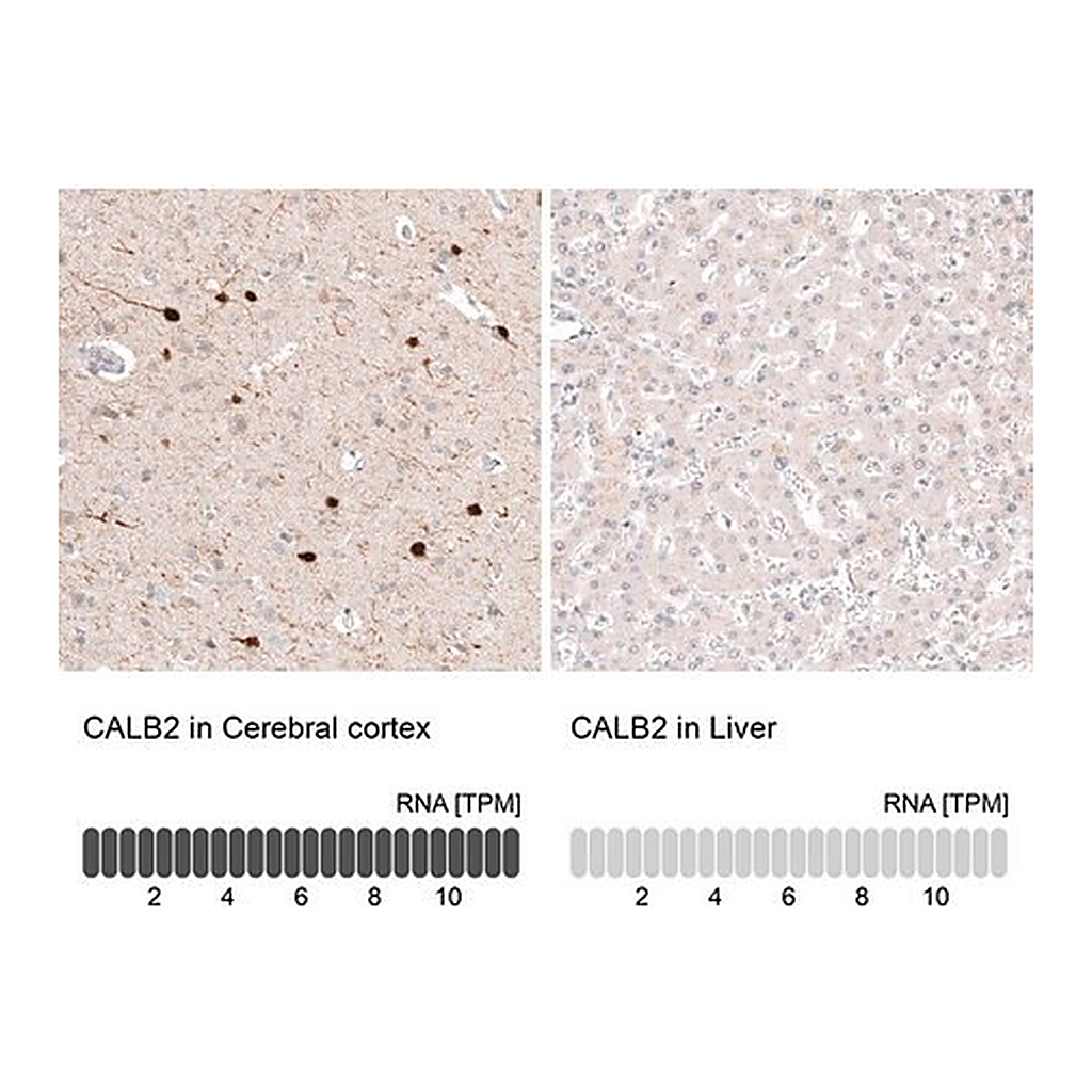 Merck Anti-CALB2 antibody produced in mouse