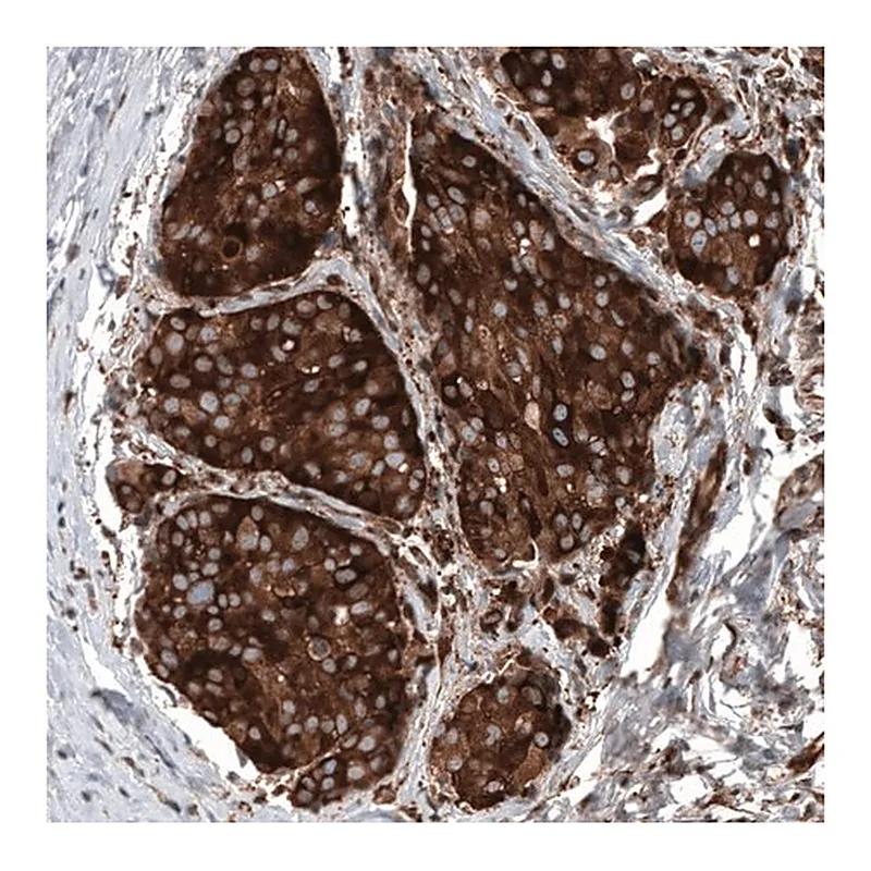 Merck Anti-GSPT1 antibody produced in mouse