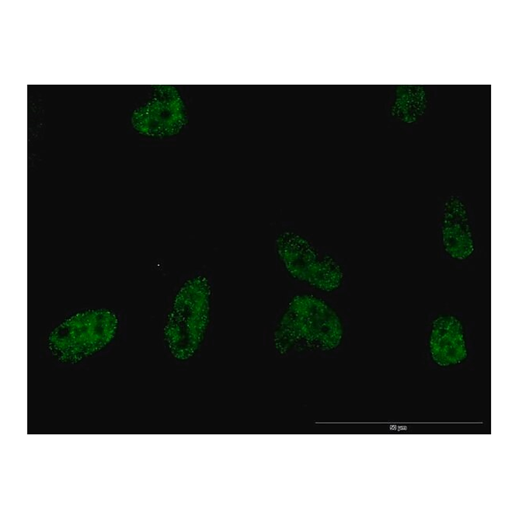 Merck Monoclonal Anti-PLCB2 antibody produced in mouse