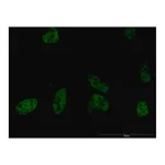 Merck Monoclonal Anti-PLCB2 antibody produced in mouse