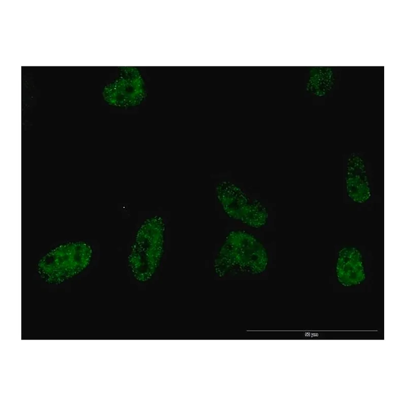Merck Monoclonal Anti-PLCB2 antibody produced in mouse