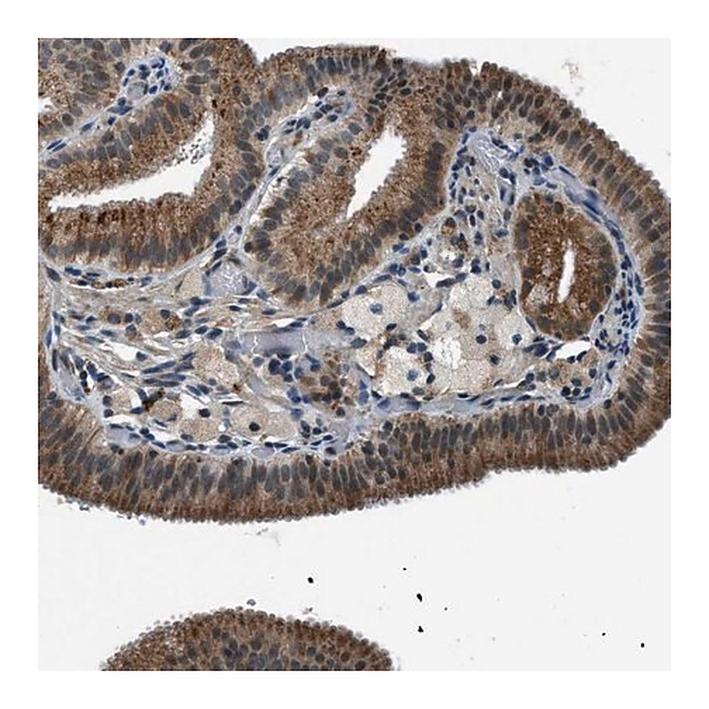 Merck Anti-GINM1 antibody produced in rabbit