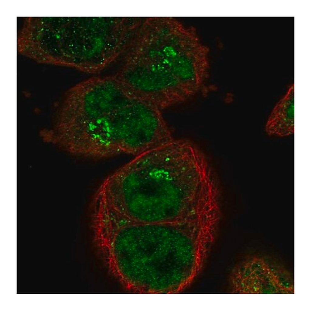 Merck Anti-SART1 antibody produced in rabbit