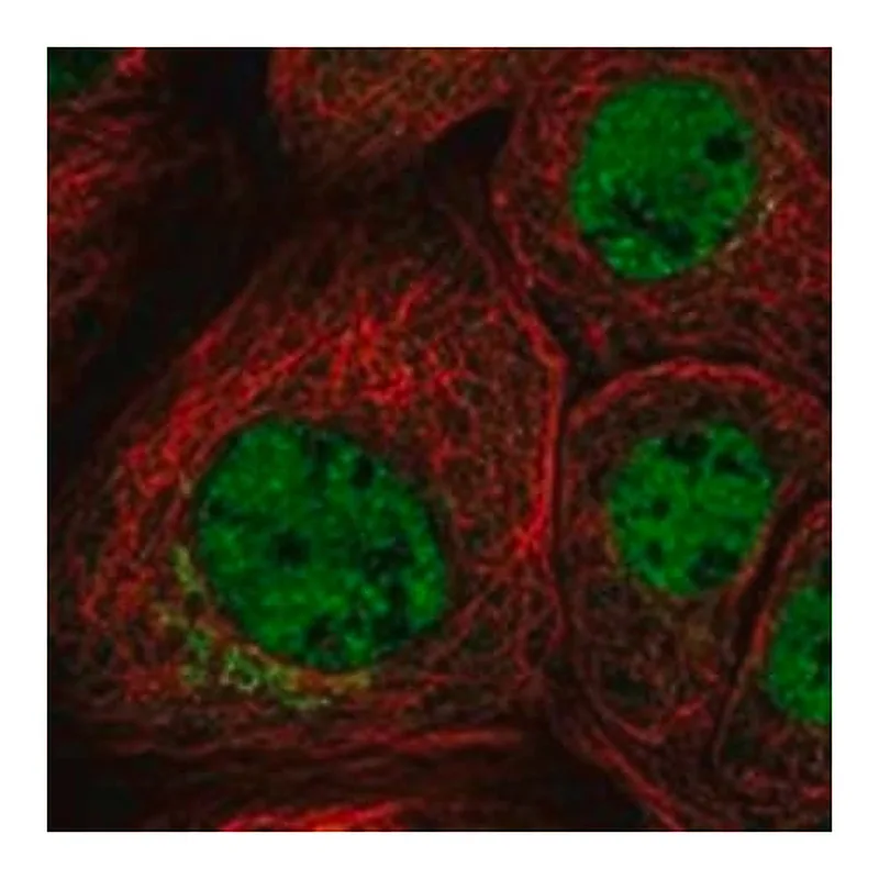 Merck Anti-LHX1 antibody produced in rabbit