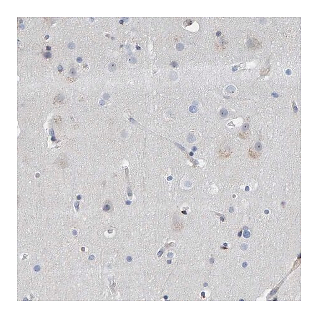 Merck Anti-MMP16 antibody produced in rabbit