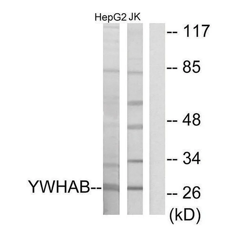 Merck Anti-14-3-3 beta antibody produced in rabbit
