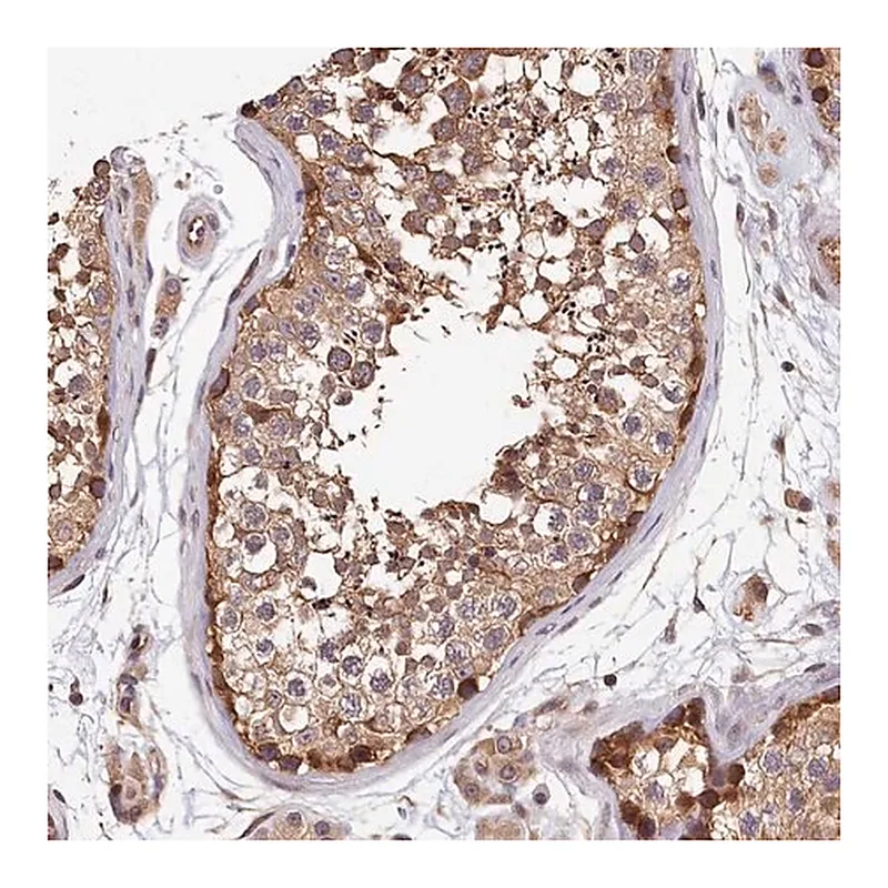Merck Anti-TMEM116 antibody produced in rabbit
