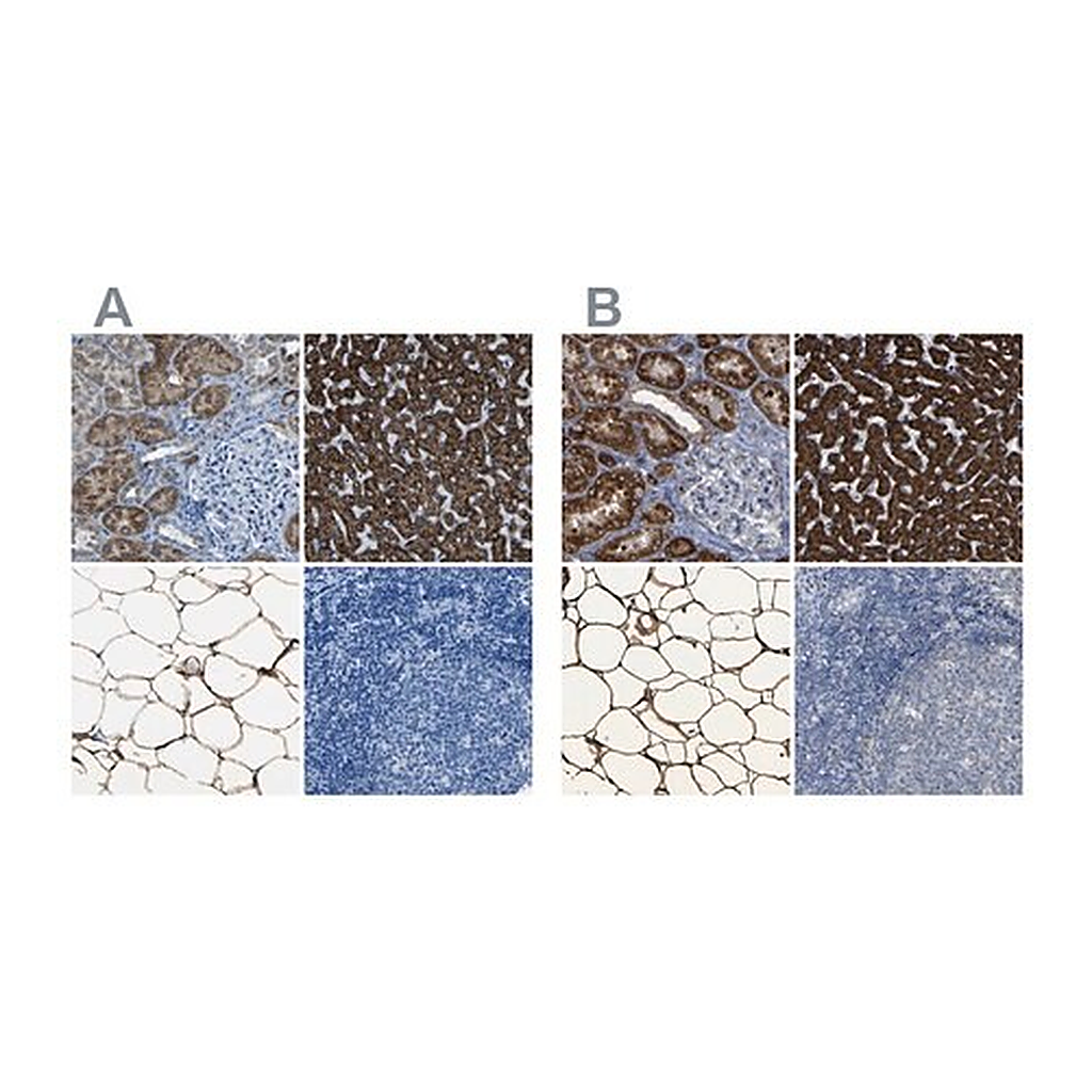 Merck Anti-ACSL1 antibody produced in rabbit