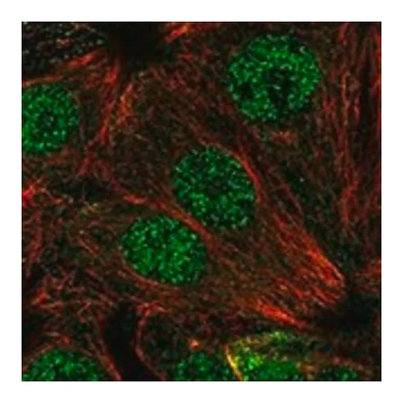 Merck Anti-SMUG1 antibody produced in rabbit