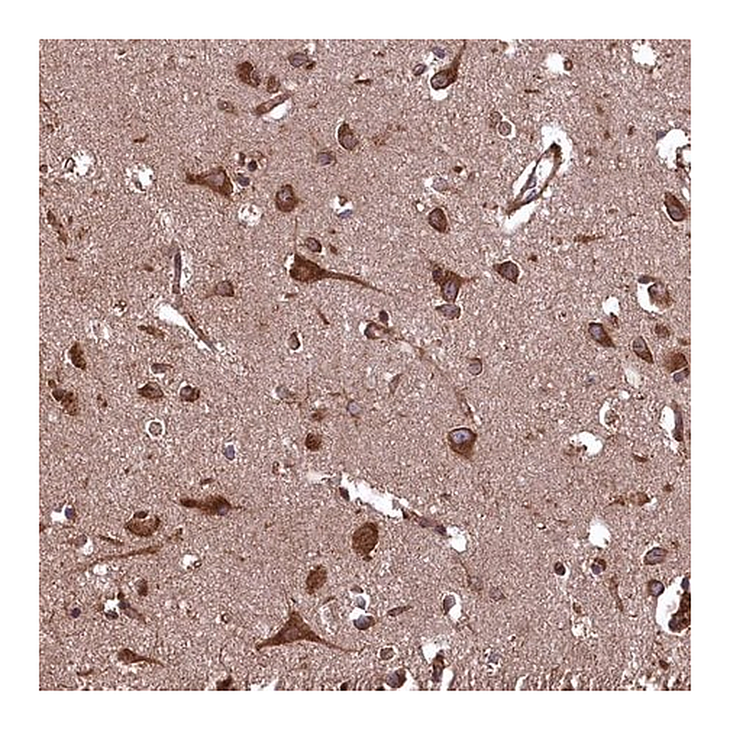 Merck Anti-PLA2G4C antibody produced in rabbit