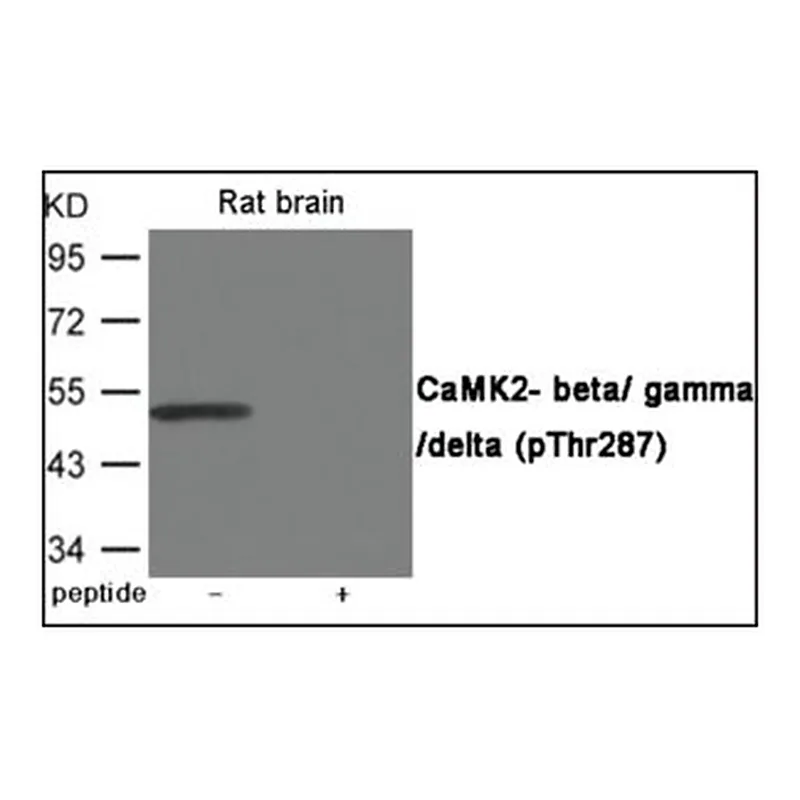 Merck ANTI-PHOSPHO-CAMK2-BETA/GAMMA/DELTA (PTH